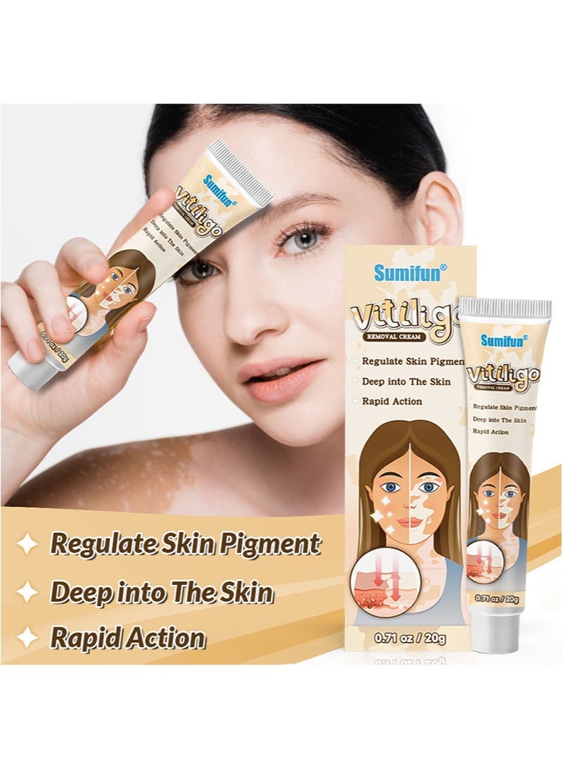 سوميفون كريم لإزالة البهاق 2 قطعة يحسن تصبغ الجلد ويقلل البقع البيضاء، تركيبة طبيعية، مناسب لجميع أنواع البشرة (20 جم + 20 جم) - Image 3